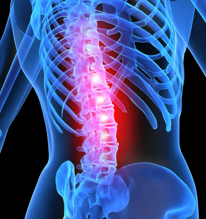 Illustration of an inflamed spine
